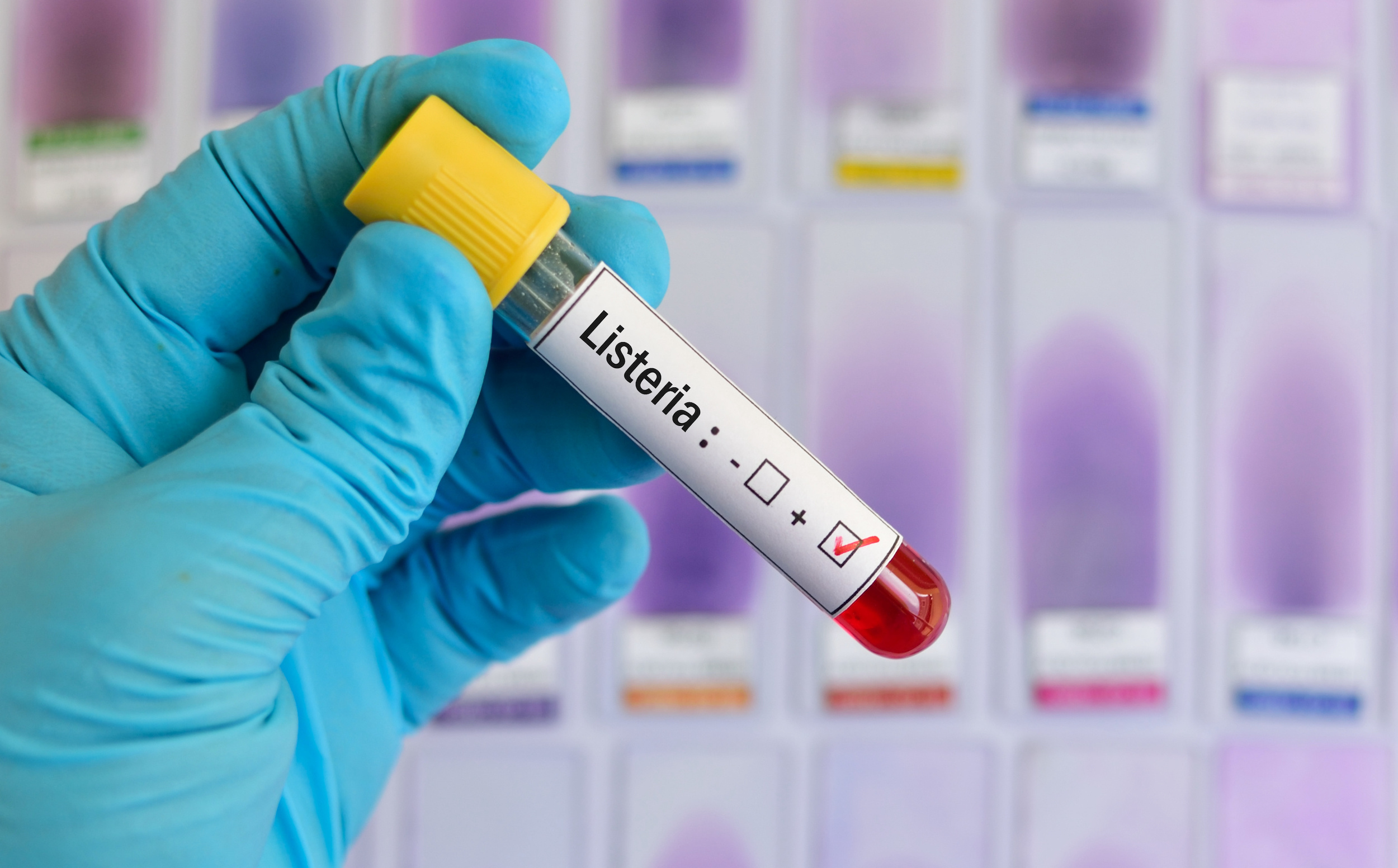 Cdc warns pregnant people not to eat certain cheeses and meats because of listeria. Image shows listeria test tube in a gloved hand.